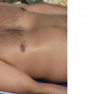 Pastropmal homme 57 ans b Pastropmal homme 57 ans b
