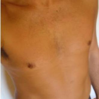 Bicool6 homme 55 ans Appenzell