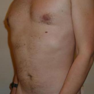 P13 homme 46 ans o
